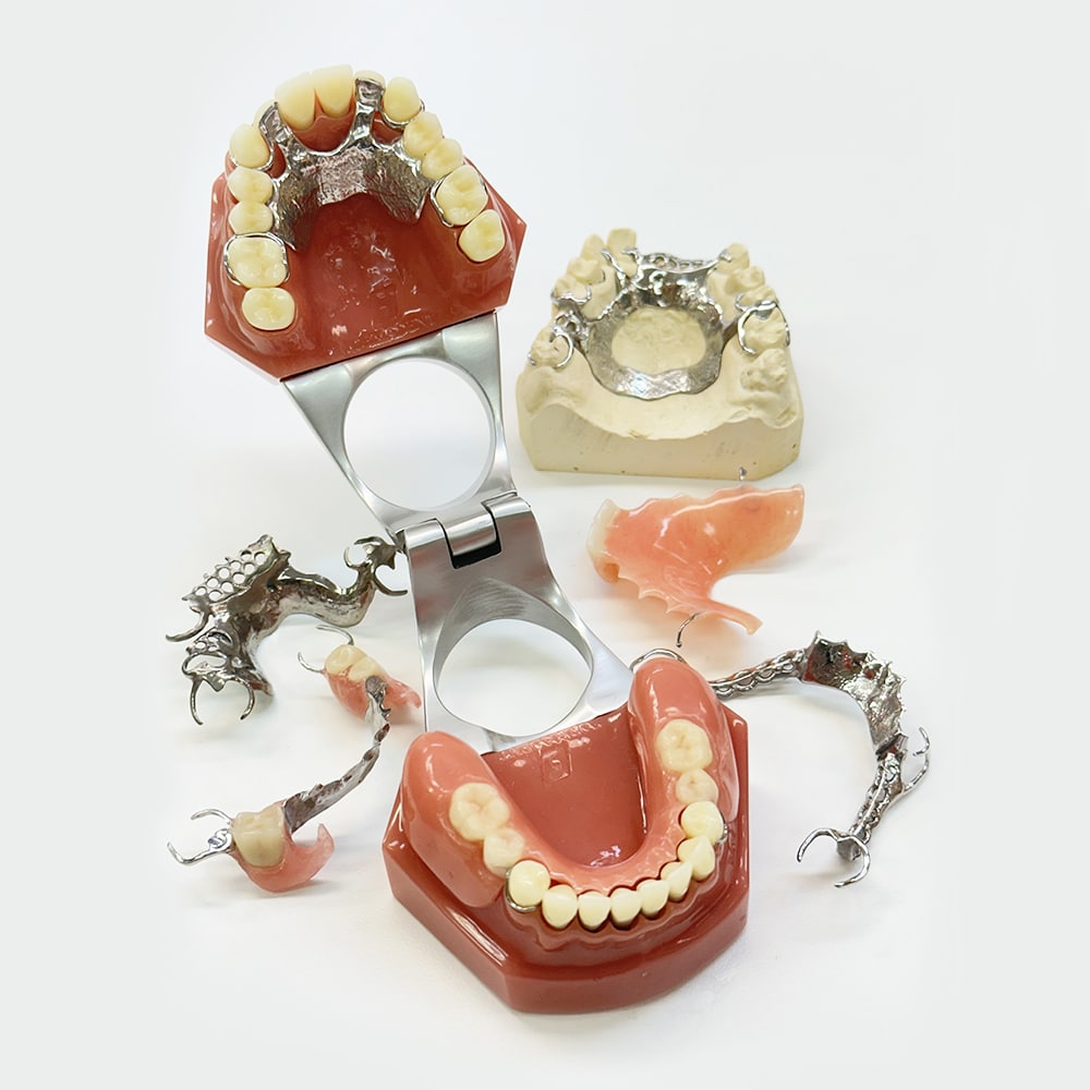 Dentier partiel